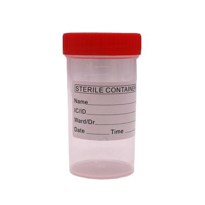 Copo de recolha de fezes de plástico PP de 50 ml/60 ml para frasco de amostra em material de laboratório